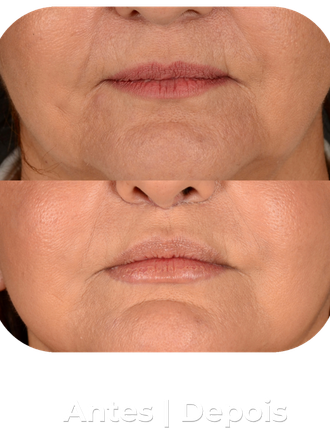 Antes e depois 3